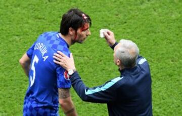 Vedran Corluka necesitando asistencia m¨¦dica tras un duro golpe.