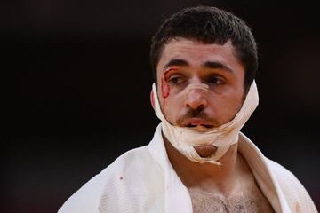 El judoca espa?ol Alberto Gaitero ha ca¨ªdo en primera ronda frente al ucraniano Heorhi Zantaraia en una pelea muy dura, en la que el espa?ol acab¨® con casi toda la cara vendada.