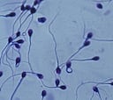 Sorprendente revelación: los espermatozoides no nadan de la forma que se creía hasta ahora