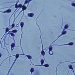 Sorprendente revelación: los espermatozoides no nadan de la forma que se creía hasta ahora