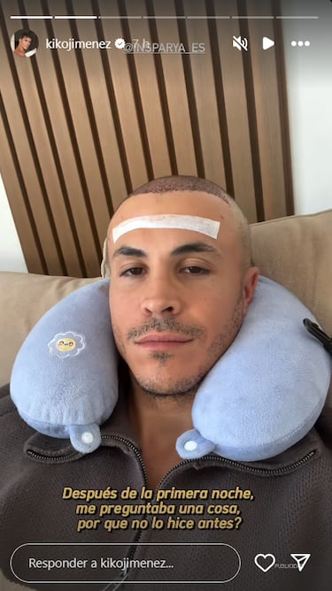 El cambio físico de Kiko Jiménez tras pasar por quirófano: “Tenía que hacer algo”