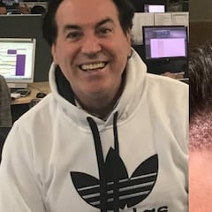 Pipi Estrada pasa por el quirófano: implantes de pelo y papada