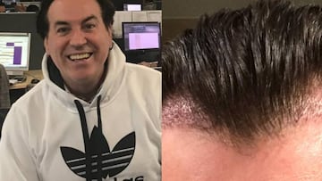 Pipi Estrada cumple 62 años tras pasar por el quirófano en dos ocasiones.