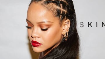 Rihanna sufre un accidente con una moto el¨¦ctrica que le deja la cara amoratada