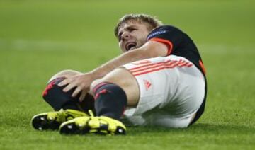 Las imágenes de la fractura de tibia de Luke Shaw