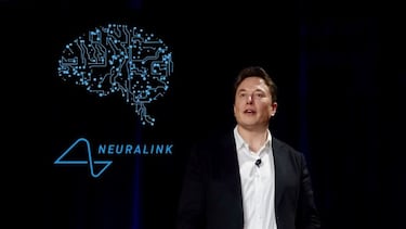 Adiós al Neuralink de Musk: el pequeño implante que promete conectar el cerebro con la inteligencia artificial