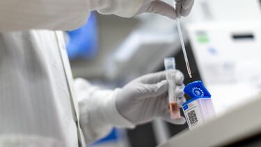 Virus VSR: Síntomas y cómo diferenciarlo de la COVID e influenza
