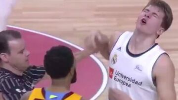 Se lió en el Palacio: Doncic se llevó este 'guantazo' en la cara