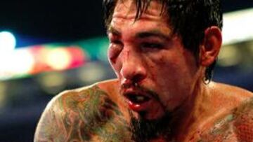 MUY TOCADO. El pújil mexicano no dio rueda de prensa y tuvo que ser desplazado a un hospital, donde le fueron descubiertas sus graves lesiones.