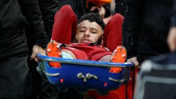 Oxlade-Chamberlain se retiró del campo en camilla en el 17'