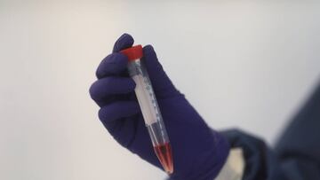 Coronavirus en México hoy 22 de octubre: últimas noticias, casos y muertes