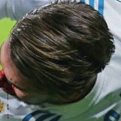 Oficial: Ramos sufre una fractura nasal; será baja ante el APOEL
