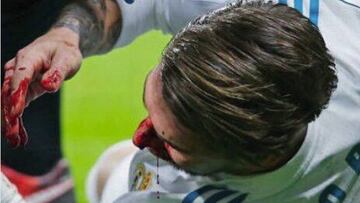 Oficial: Ramos sufre una fractura nasal; será baja ante el APOEL