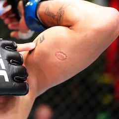 UFC despide a Igor Severino por morder a Andre Lima