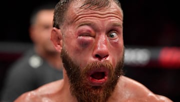 Donald Cerrone tras su combate en el UFC 238.