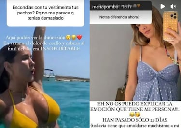 María Pombo muestra el resultado de su operación de pecho