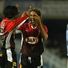 "Jugué con un trozo de bistec en el pie para aliviar el dolor"