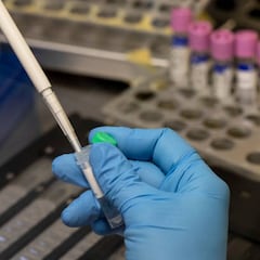 Desvelan una de las secuelas más frecuentes de la COVID