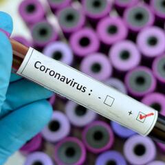 Se confirma el caso 15 de Coronavirus en Estados Unidos