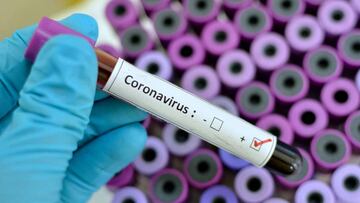 Un paciente de Texas fue descubierto como la d&eacute;cimo quinta v&iacute;ctima del Coronavirus, seg&uacute;n revelaron autoridades este jueves despu&eacute;s de la inspecci&oacute;n.