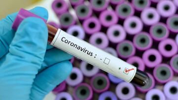 Un paciente de Texas fue descubierto como la d&eacute;cimo quinta v&iacute;ctima del Coronavirus, seg&uacute;n revelaron autoridades este jueves despu&eacute;s de la inspecci&oacute;n.