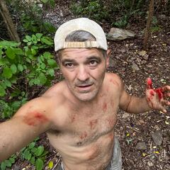 La imagen de Frank Cuesta que ha preocupado a sus fans: “La paliza que me ha dado”