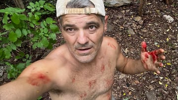 La imagen de Frank Cuesta que ha preocupado a sus fans: ¡°La paliza que me ha dado¡±. Fuente: Instagram.