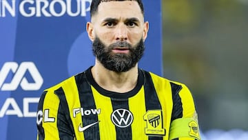 Conceiçao señala a los culpables del ‘caso Benzema’