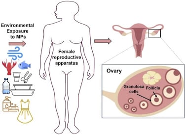 Encuentran microplásticos en ovarios de mujeres