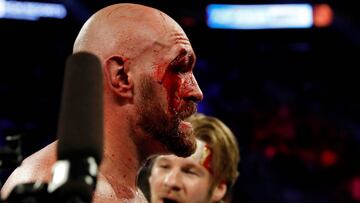 Tyson Fury, tras su combate con Otto Wallin.