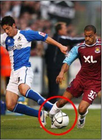 Kieron Dyer se rompió la pierna derecha en dos partes en 2007.    