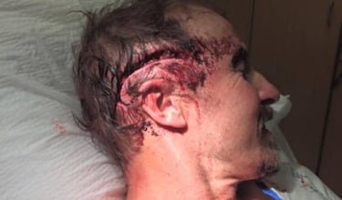 Un hombre se graba despu¨¦s de ser atacado por un oso