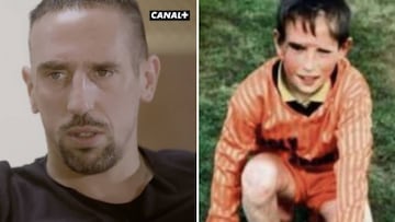 Ribery habla de su dura infancia y de la cicatriz que marc&oacute; su vida. Foto: Redes sociales