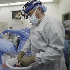 ¿Qué tan exitoso fue el trasplante de riñón de cerdo a un hombre con muerte cerebral?