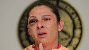 Ana Gabriela Guevara da su versión de los hechos sobre su ataque