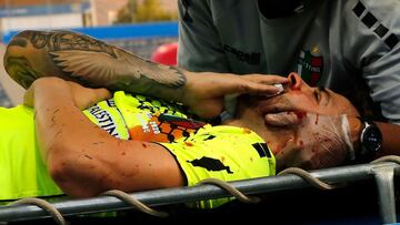 Federico Lanzillota chocó con Fernando Zampedri y quedó muy complicado en su área. Tanto sus compañeros como sus rivales mostraron preocupación por el argentino.