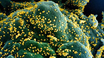 (FILES) In this undated handout image obtained July 15, 2020, courtesy of National Institute of Allergy and Infectious Diseases(NIH/NIAID), shows a colorized scanning electron micrograph of an apoptotic cell (blue/green) heavily infected with SARS-COV-2 virus particles (yellow), isolated from a patient sample, captured at the NIAID Integrated Research Facility (IRF) in Fort Detrick, Maryland. - US pharmaceutical company Eli Lilly's combination of two synthetic antibodies against Covid-19 reduced hospitalizations and deaths by 70 percent in high-risk patients with recent positive tests, the company said on January 26, 2021. "Bamlanivimab and etesevimab together have the potential to be an important treatment that significantly reduces hospitalizations and death in high-risk COVID-19 patients," Lilly's chief scientific officer Daniel Skovronsky said. (Photo by Handout / National Institute of Allergy and Infectious Diseases / AFP) / RESTRICTED TO EDITORIAL USE - MANDATORY CREDIT "AFP PHOTO /NATIONAL INSTITUTE OF ALLERGY AND INFECTIOUS DISEASES/HANDOUT " - NO MARKETING - NO ADVERTISING CAMPAIGNS - DISTRIBUTED AS A SERVICE TO CLIENTS