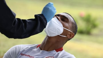 La Liga 1 arriesga la salud de futbolistas y trabajadores