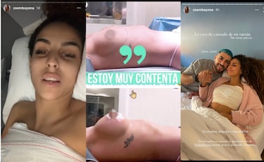 Zoe muestra el resultado de su operación de pecho: “Estoy muy contenta”