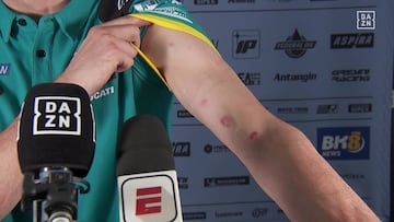 Álex Márquez muestra las señales de los trozos de asfalto que le golpearon