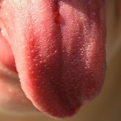 Alertan de un nuevo síntoma: 'lengua COVID'