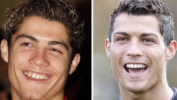 Cristiano Ronaldo utiliz&oacute; ortodoncia para mejorar su dentadura.