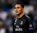 Keylor: "Pasé de ganar tres Champions seguidas a no jugar"