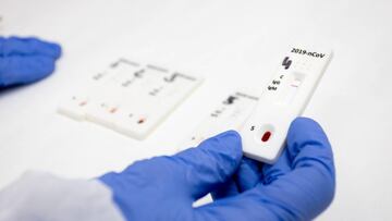 Aragón detecta 681 nuevos casos de coronavirus procedentes de 3.428 PCR.