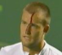Youzhny, el tenista capaz de abrirse la cabeza para ganar un partido