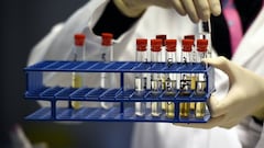 Doping: 95% of Liga players unaware of existence of WADA