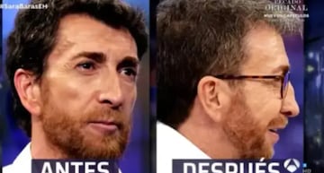 El antes y después de Pablo Motos. Fuente: ATRESMEDIA