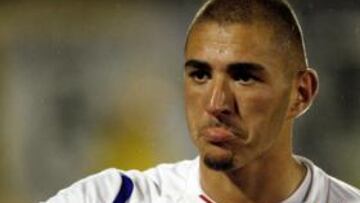 <b>SENSATO. </b>El técnico Claude Puel dijo que no se retendrá a Benzema.