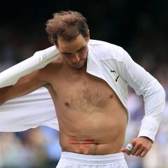 ¿Cómo afecta la lesión abdominal al juego de Nadal?