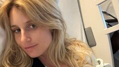 El accidente “freak” que ha obligado a Anna Gasser a operarse